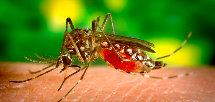 Microcefalia – Infección por virus Zika